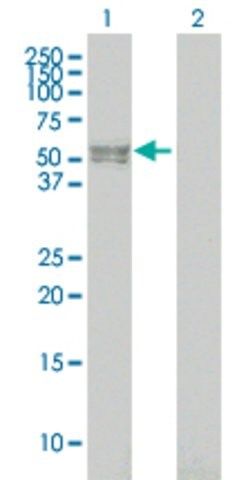 Monoclonal Anti-BMPR1B antibody produced in mouse