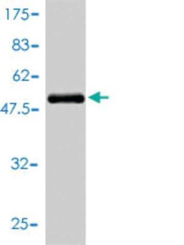 Monoclonal Anti-BLVRA antibody produced in mouse