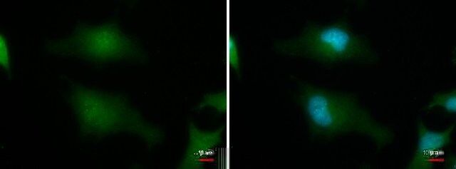 Monoclonal Anti-C19orf62 antibody produced in mouse