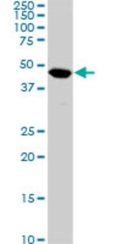 Monoclonal Anti-C17ORF75, (N-terminal) antibody produced in mouse