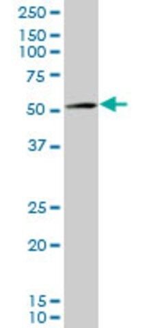 Monoclonal Anti-AMACR antibody produced in mouse