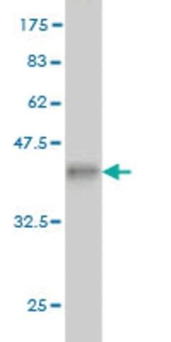 Monoclonal Anti-BCS1L antibody produced in mouse