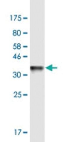 Monoclonal Anti-ARPM1 antibody produced in mouse