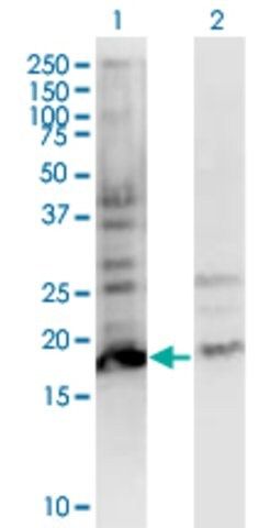 Monoclonal Anti-BTF3L4 antibody produced in mouse