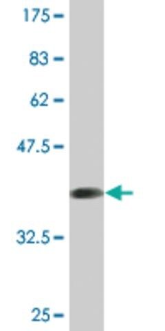 Monoclonal Anti-BMPR2 antibody produced in mouse