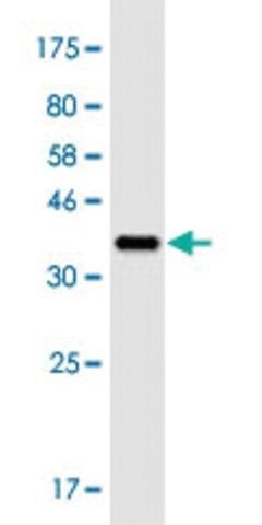 Monoclonal Anti-CABIN1 antibody produced in mouse