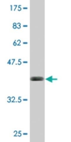 Monoclonal Anti-BST2, (C-terminal) antibody produced in mouse