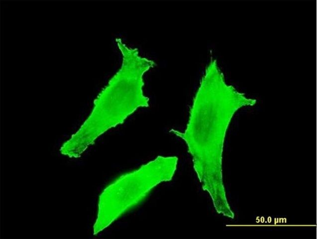 Monoclonal Anti-BTLA, (C-terminal) antibody produced in mouse