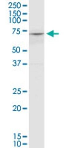 Monoclonal Anti-COL8A2 antibody produced in mouse