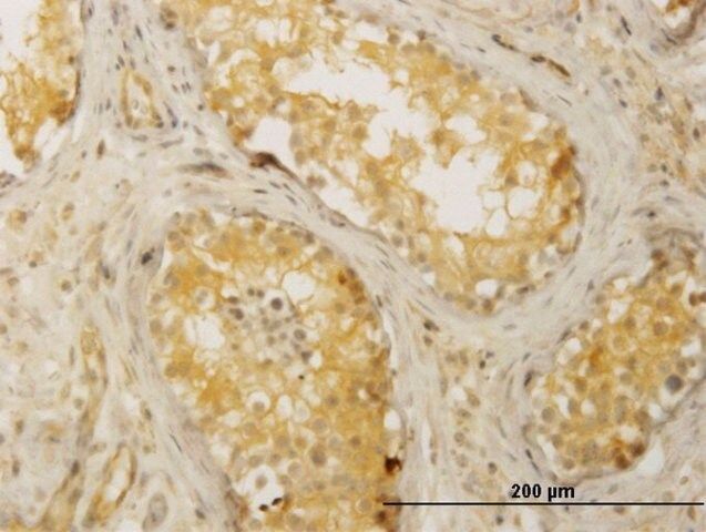 Monoclonal Anti-CDC42BPB antibody produced in mouse