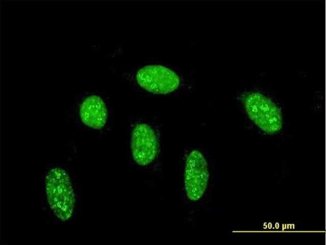 Monoclonal Anti-CDX1 antibody produced in mouse