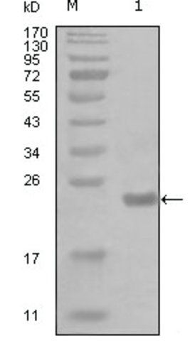 Monoclonal Anti-CHUK antibody produced in mouse