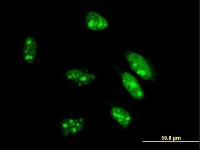 Monoclonal Anti-CDX1 antibody produced in mouse