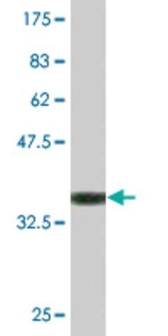 Monoclonal Anti-CLEC1B, (C-terminal) antibody produced in mouse