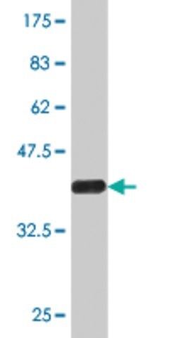 Monoclonal Anti-CPS1, (C-terminal) antibody produced in mouse