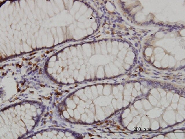 Monoclonal Anti-CDK5RAP3 antibody produced in mouse