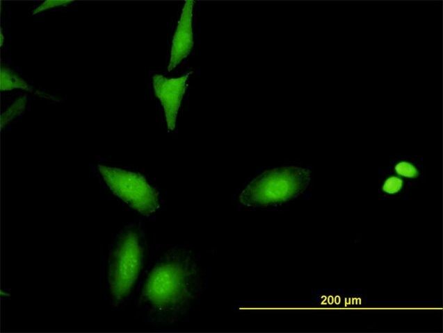 Monoclonal Anti-CRADD antibody produced in mouse