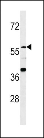 ANTI-ZNF776(N-TERMINAL) antibody produced in rabbit