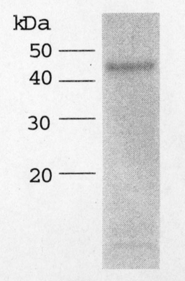 ADAMTS-4, recombinant, His Tagged