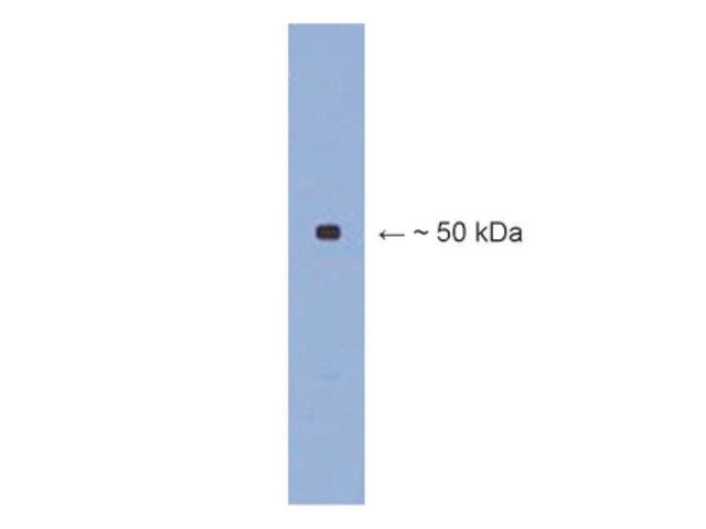 Anti- III tubulin Antibody