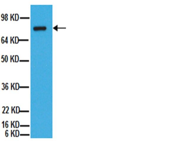 Anti-ADAM 10 Antibody, CT