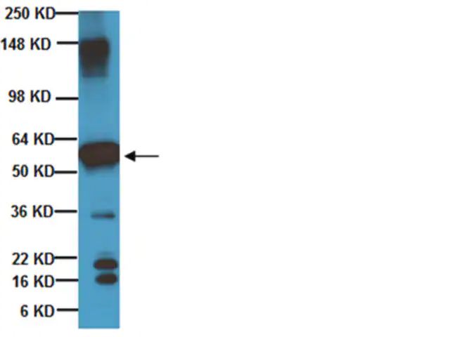 Anti-Beta III Tubulin Antibody