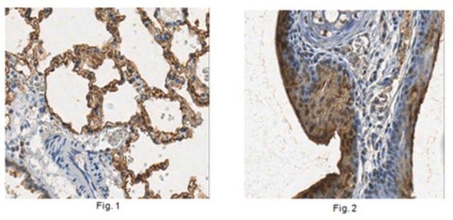 Anti-Aquaporin 5 Antibody