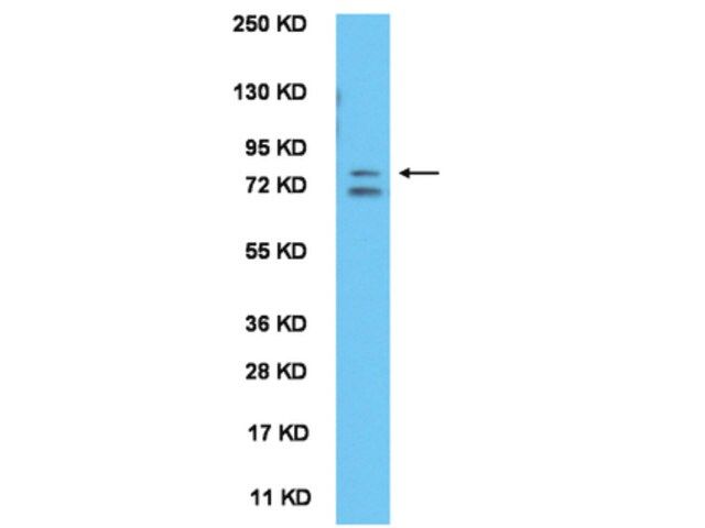 Anti-ABBA Antibody