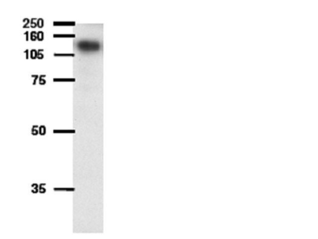 Anti-ATP-binding cassette Antibody, sub-family B (MDR/TAP), member 1A