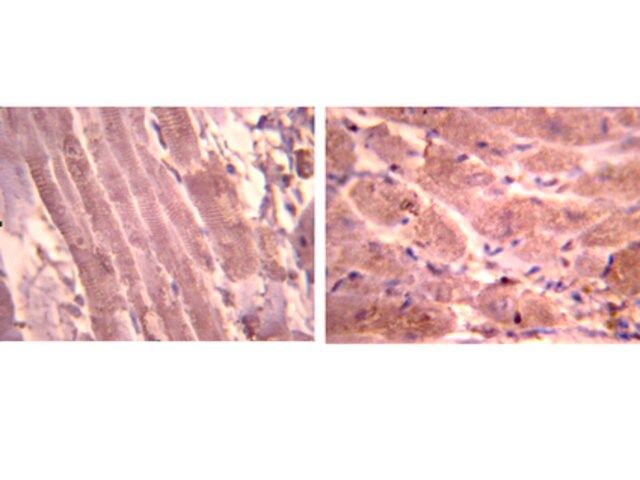 Anti-Atrial Natriuretic Polypetide Antibody, alpha