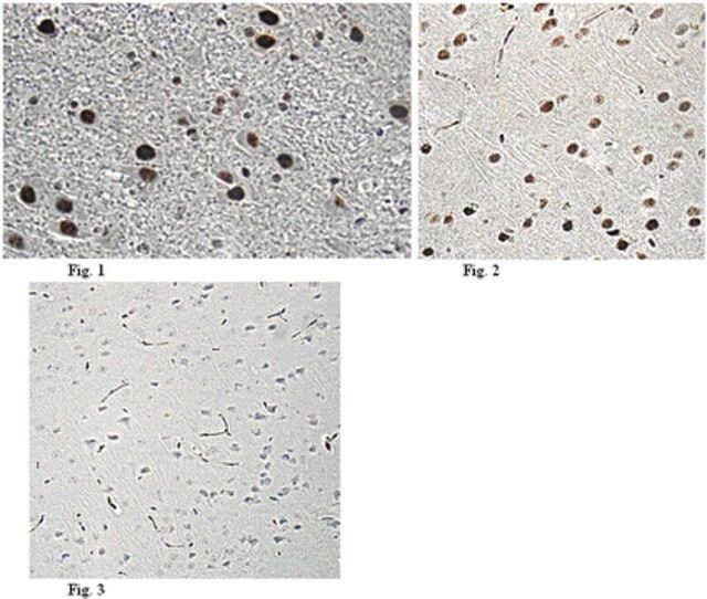 Anti-Bcl-2-associated transcription factor 1 Antibody