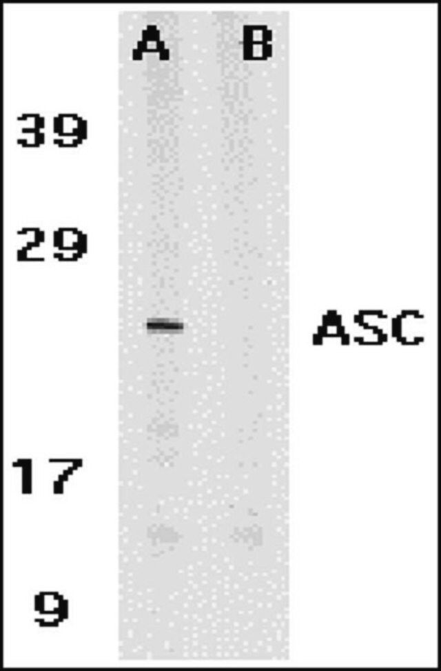 Anti-ASC Antibody