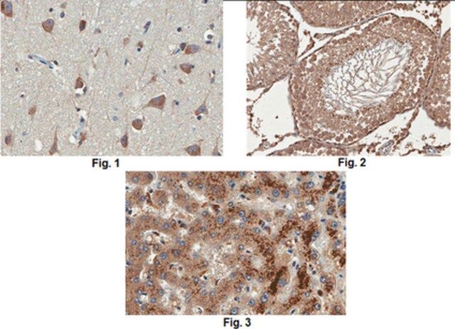 Anti-beta-Arrestin-2 Antibody, clone 5E12.1