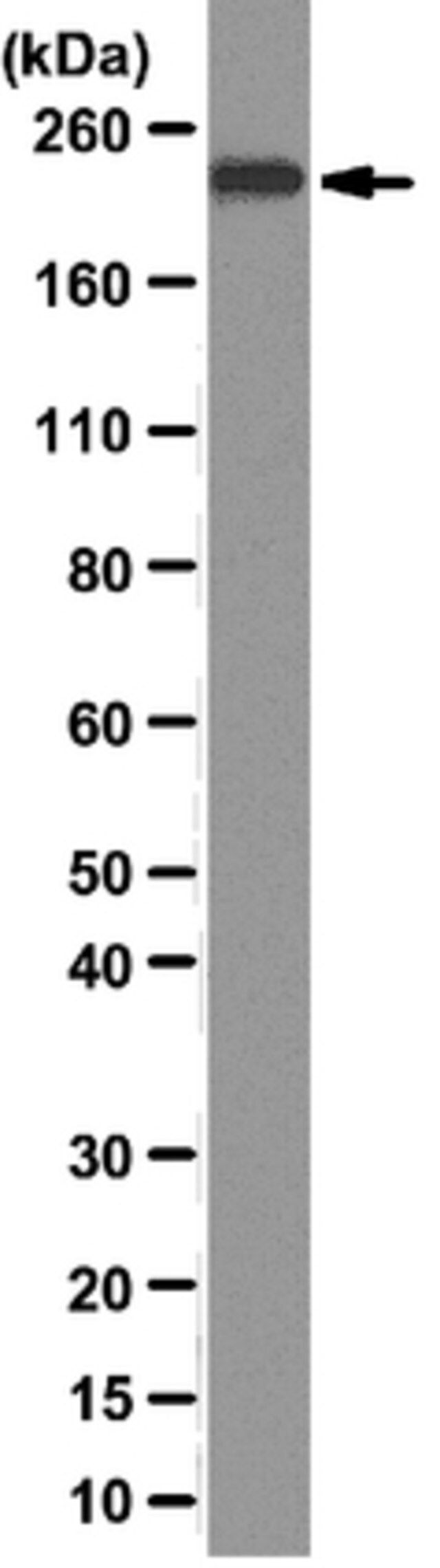 Anti-BRG1 Antibody, clone 3G4