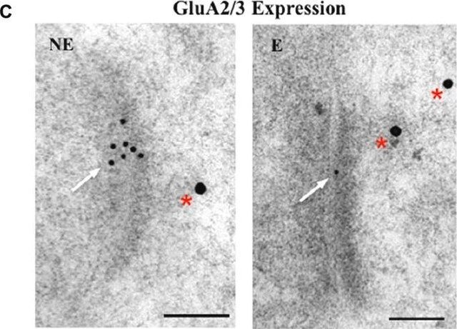 Anti-Glutamate Receptor 2 &3 Antibody