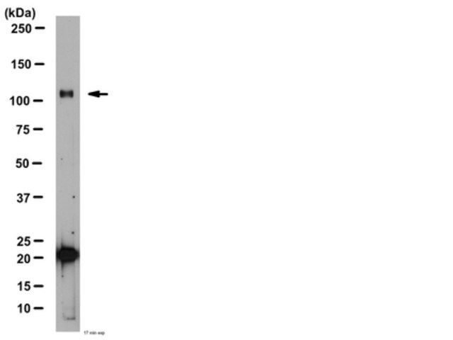 Anti-Glutamate Receptor Delta 1/2 Antibody