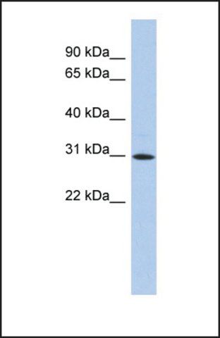 Anti-ZNF771, (N-terminal) antibody produced in rabbit