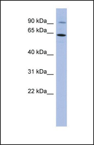 Anti-ZNF778, (N-terminal) antibody produced in rabbit