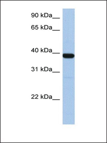 Anti-ZNF781 antibody produced in rabbit