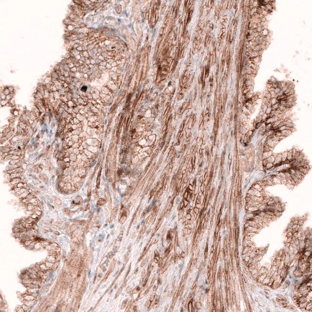 Monoclonal Anti-ROR2 antibody produced in mouse