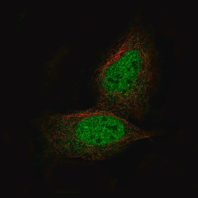 Monoclonal Anti-PRAME antibody produced in mouse