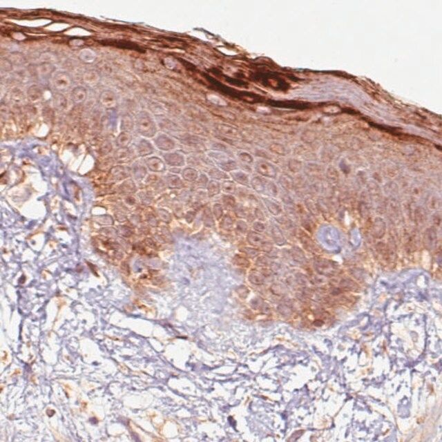 Monoclonal Anti-RNASE7 antibody produced in mouse