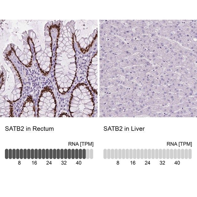 Monoclonal Anti-SATB2 antibody produced in mouse