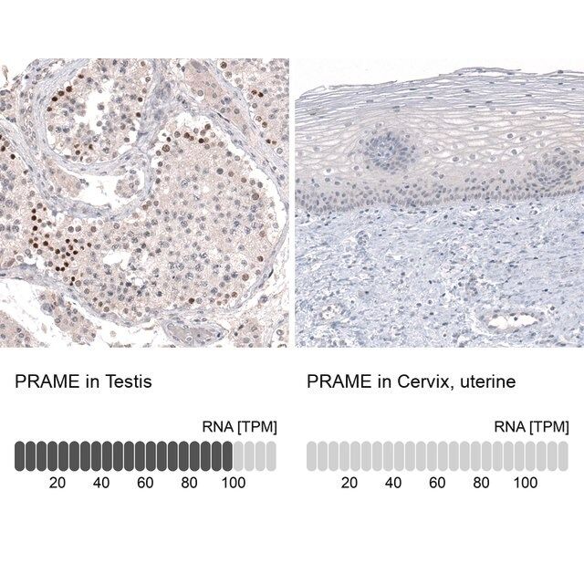 Monoclonal Anti-PRAME antibody produced in mouse