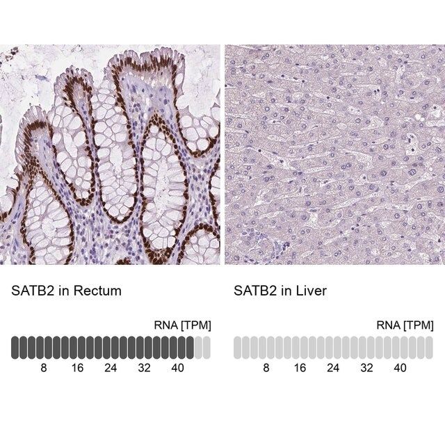 Monoclonal Anti-SATB2 antibody produced in mouse