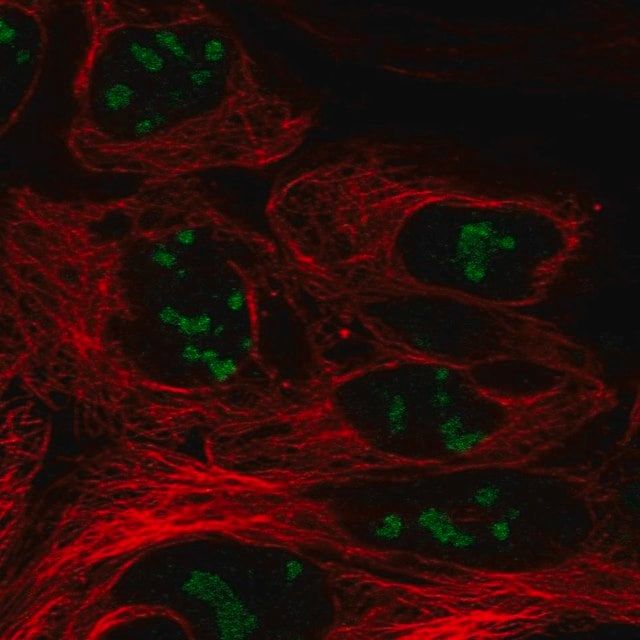 Anti-CC2D2B antibody produced in rabbit