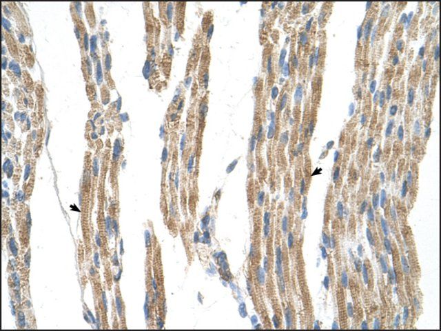 Anti-GPT (AB1) antibody produced in rabbit