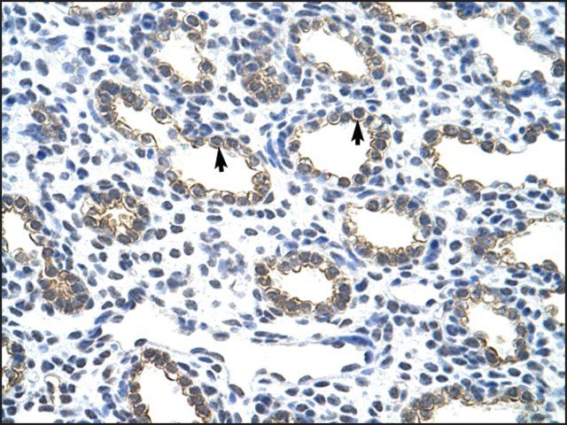 Anti-KRT18 (AB2) antibody produced in rabbit