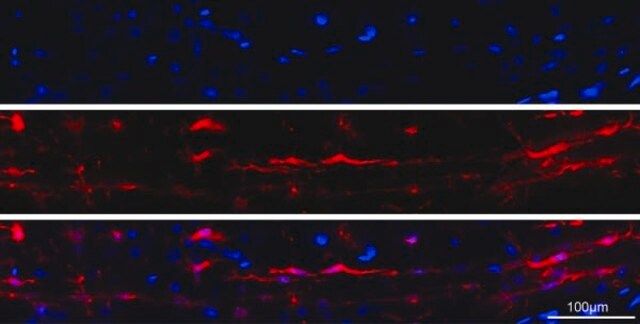 Anti-Iba1/AIF1 Antibody