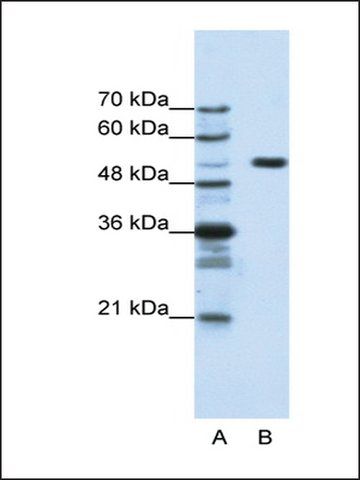 Anti-HCFC1 antibody produced in rabbit